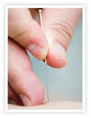 Dry Needling